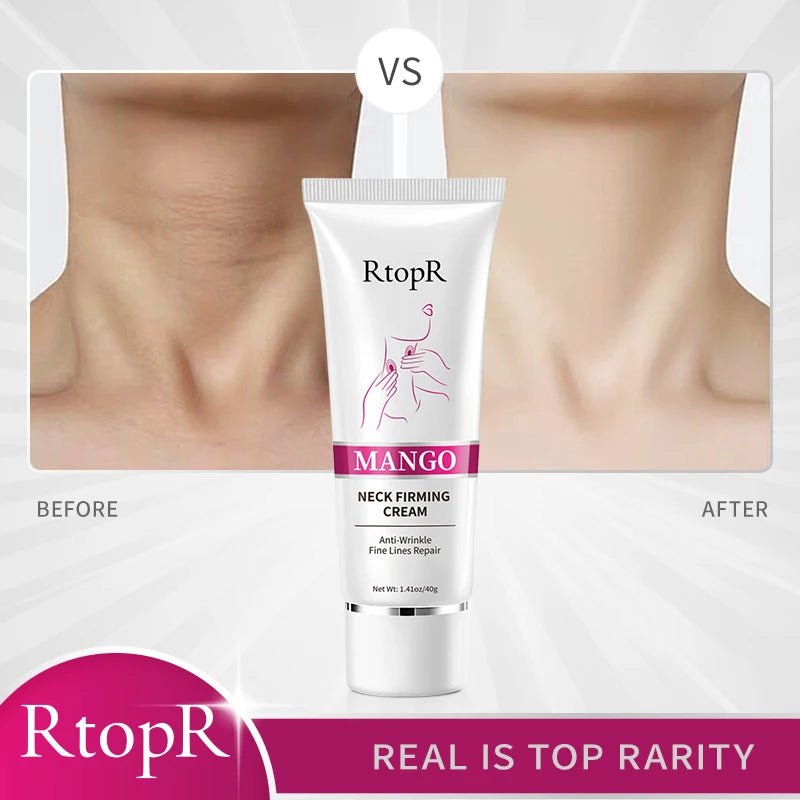 RtopR Neck Firming Wrinkle Remover Cream Rejuvenation Firming Skin