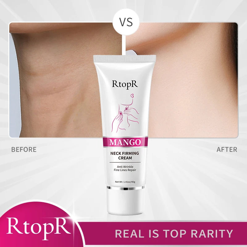 RtopR Neck Firming Wrinkle Remover Cream Rejuvenation Firming Skin